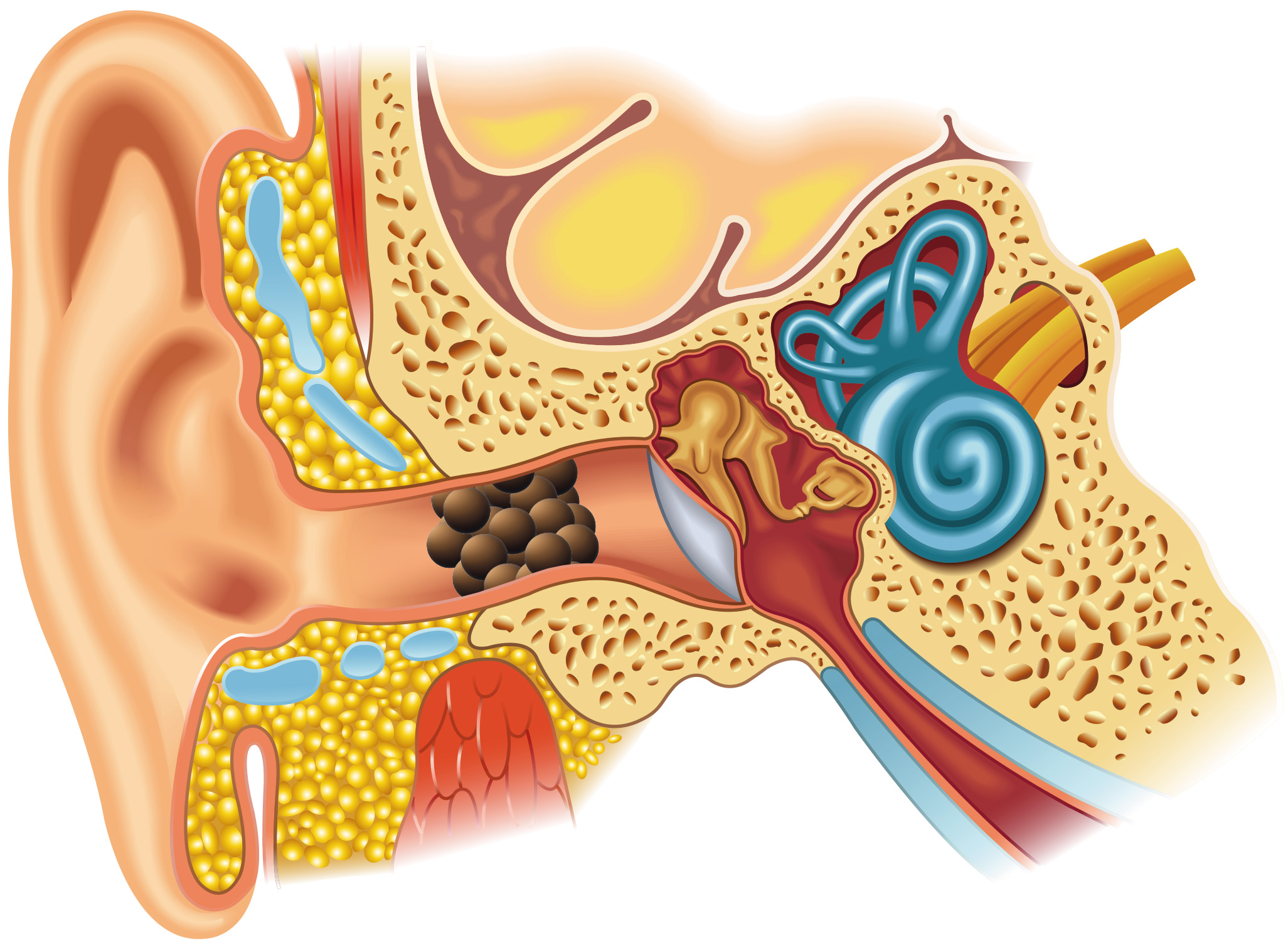Hygiène de l'oreille et bouchon
